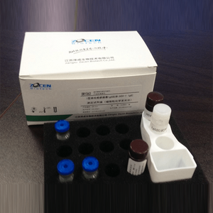 Test de diagnostic de peptide natriurétique pro-cerveau N-terminal, marqueurs cardiaques, analyseur d'immunoessai automatisé NT-proBNP