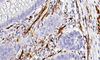 Réactif anticorps S100 (immunohistochimie)