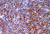 Réactif protéique cycline D1 ProtéineAnticorps (immunohistochimie)