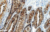 Réactif anticorps antigène carcinoembryonnaire (CEA) (immunohistochimie)