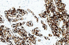 Cytokératine (large spectre)Réactif anticorps (immunohistochimie)